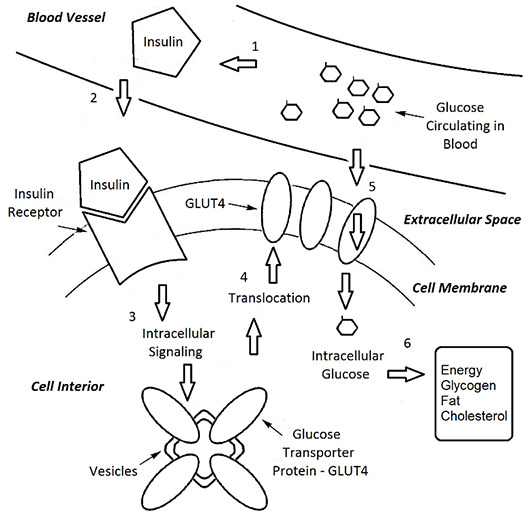 diabetes diagram